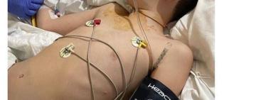 10-річний хлопчик стрибнув із 6 поверху через гру у "Синього кита"